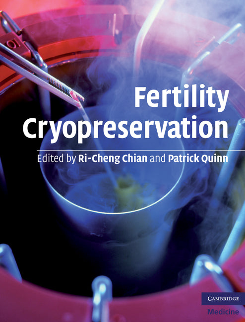 Fertility Cryopreservation (Hardback) 9780521517782