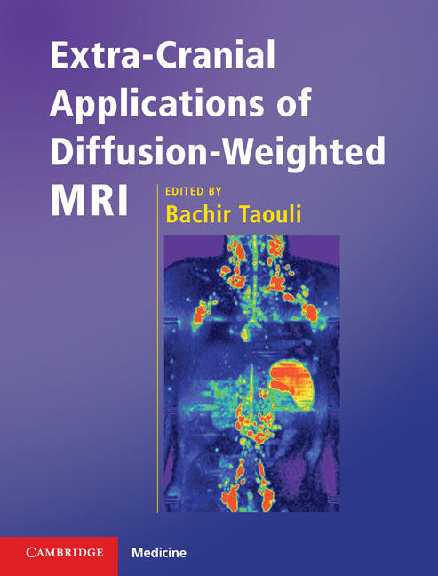 Extra-Cranial Applications of Diffusion-Weighted MRI (Hardback) 9780521518697