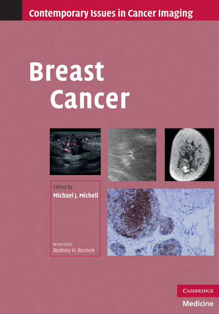 Breast Cancer (Hardback) 9780521519502