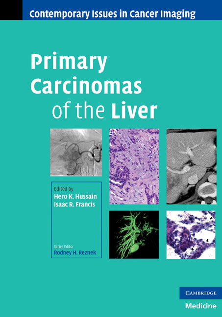 Primary Carcinomas of the Liver (Hardback) 9780521519519