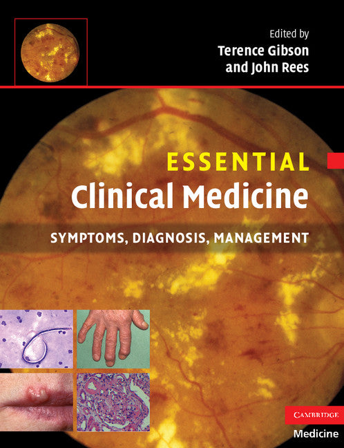 Essential Clinical Medicine; Symptoms, Diagnosis, Management (Paperback) 9780521543651