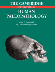 The Cambridge Encyclopedia of Human Paleopathology (Paperback / softback) 9781107403772