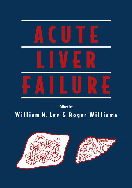 Acute Liver Failure (Hardback) 9780521553810