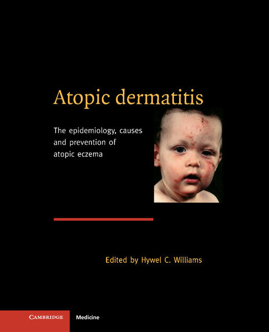 Atopic Dermatitis; The Epidemiology, Causes and Prevention of Atopic Eczema (Hardback) 9780521570756