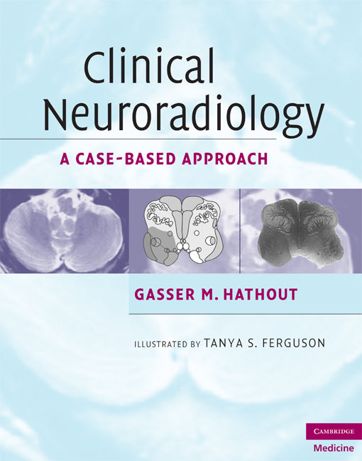 Clinical Neuroradiology; A Case-Based Approach (Hardback) 9780521600545