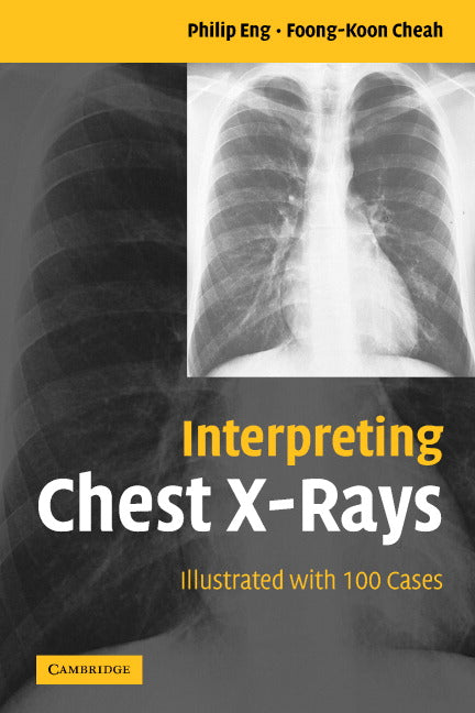 Interpreting Chest X-Rays; Illustrated with 100 Cases (Paperback) 9780521607322