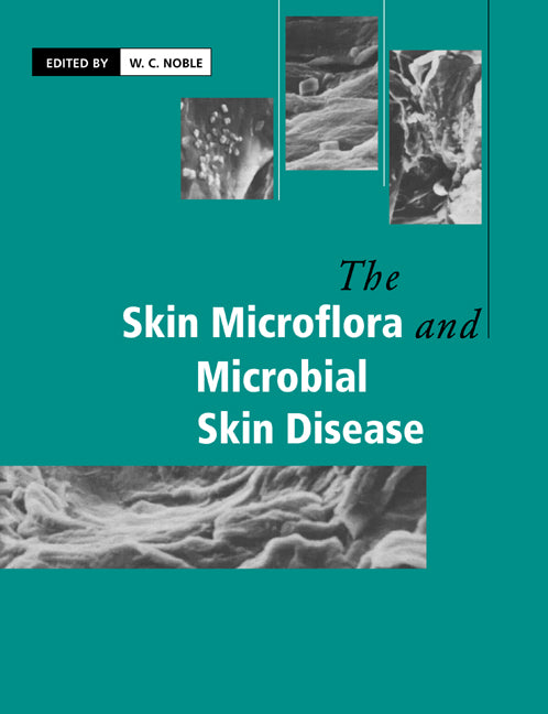 The Skin Microflora and Microbial Skin Disease (Paperback) 9780521612067