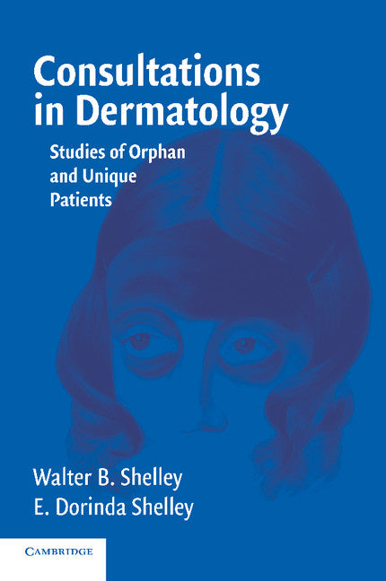 Consultations in Dermatology; Studies of Orphan and Unique Patients (Paperback) 9780521616584