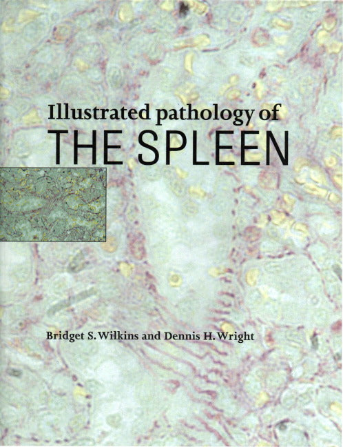 Illustrated Pathology of the Spleen (Hardback) 9780521622271
