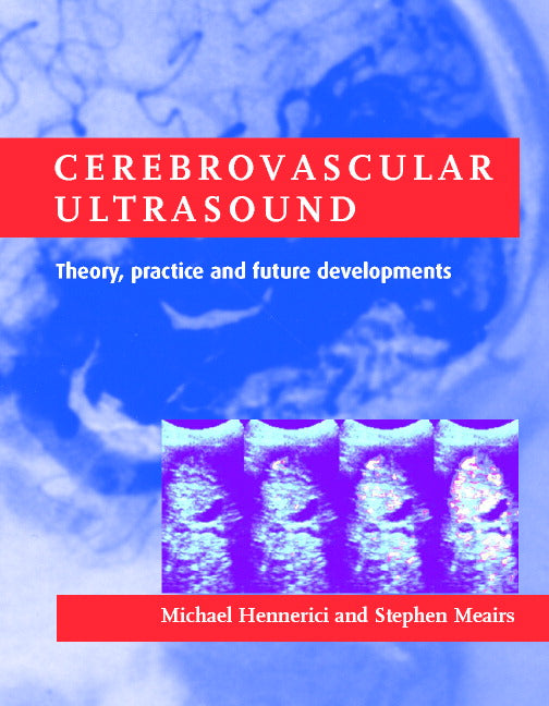 Cerebrovascular Ultrasound; Theory, Practice and Future Developments (Hardback) 9780521632232