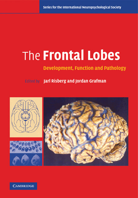 The Frontal Lobes; Development, Function and Pathology (Paperback) 9780521672252