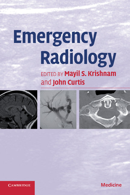 Emergency Radiology (Paperback) 9780521672474