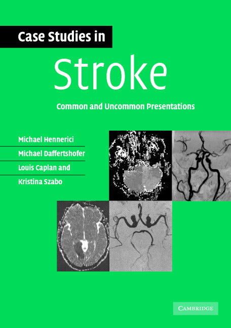 Case Studies in Stroke; Common and Uncommon Presentations (Paperback) 9780521673679