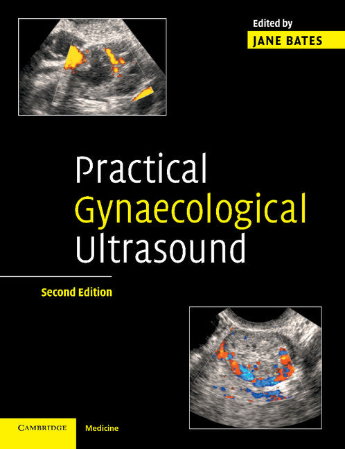 Practical Gynaecological Ultrasound (Paperback) 9780521674508