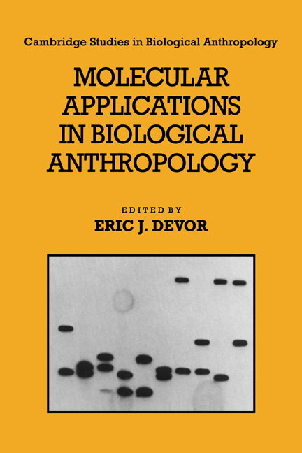 Molecular Applications in Biological Anthropology (Paperback) 9780521675529