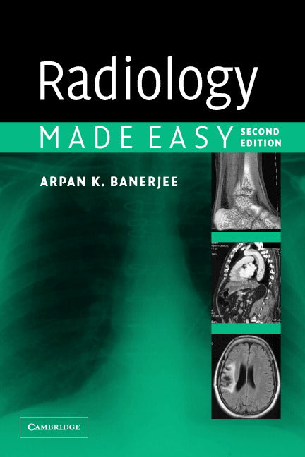 Radiology Made Easy (Paperback) 9780521676359