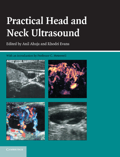 Practical Head and Neck Ultrasound (Paperback) 9780521683210