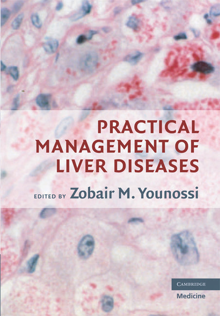 Practical Management of Liver Diseases (Hardback) 9780521684897