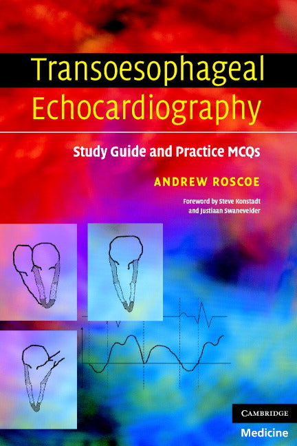 Transoesophageal Echocardiography; Study Guide and Practice MCQs (Paperback) 9780521689601