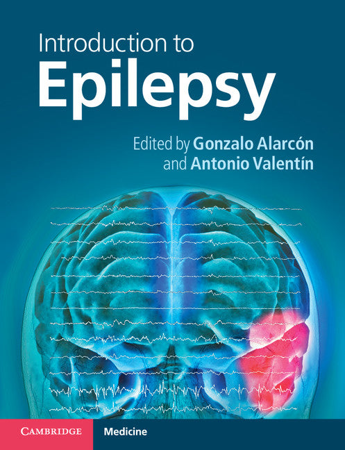 Introduction to Epilepsy (Paperback) 9780521691581