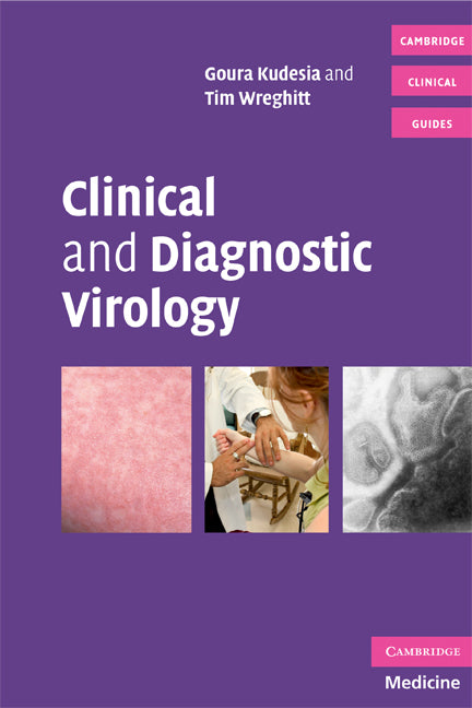 Clinical and Diagnostic Virology (Paperback) 9780521694674