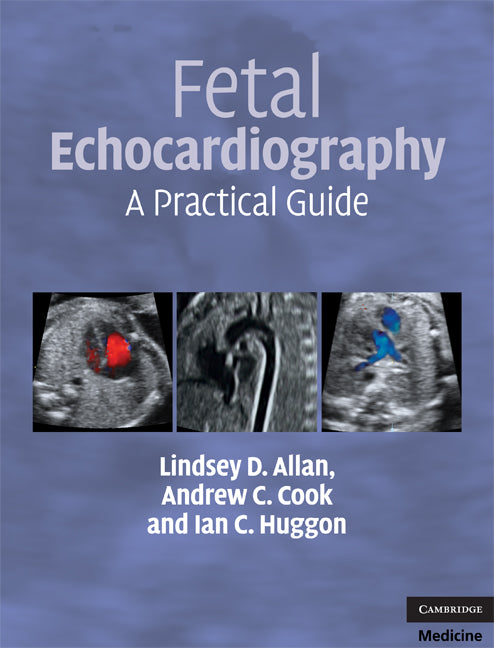 Fetal Echocardiography; A Practical Guide (Hardback) 9780521695206