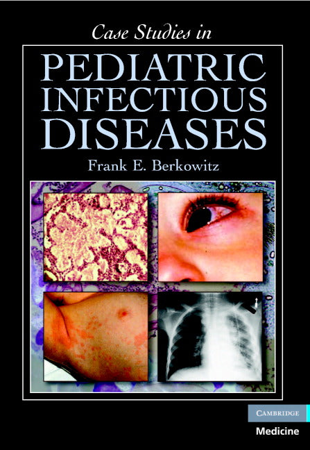 Case Studies in Pediatric Infectious Diseases (Paperback) 9780521697613