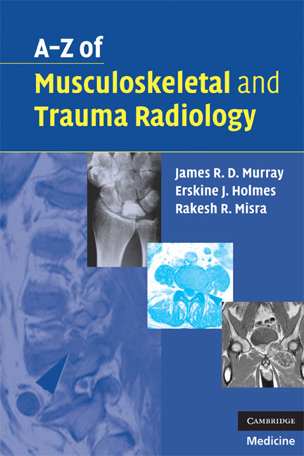 A-Z of Musculoskeletal and Trauma Radiology (Paperback) 9780521700139