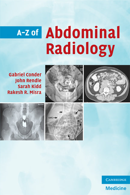 A-Z of Abdominal Radiology (Paperback) 9780521700146