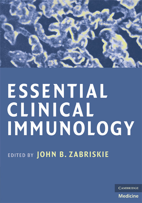 Essential Clinical Immunology (Paperback) 9780521704892