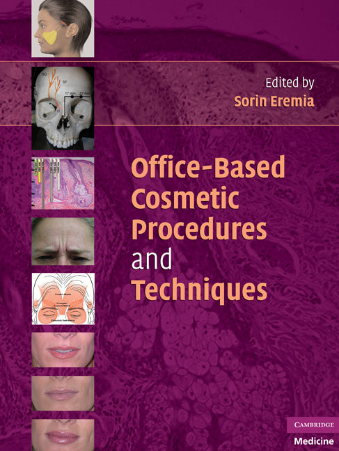 Office-Based Cosmetic Procedures and Techniques (Hardback) 9780521706520