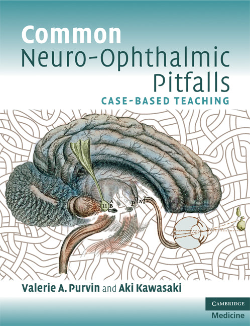 Common Neuro-Ophthalmic Pitfalls; Case-Based Teaching (Paperback) 9780521713269