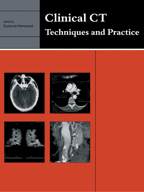 Clinical CT; Techniques and Practice (Paperback) 9780521715089