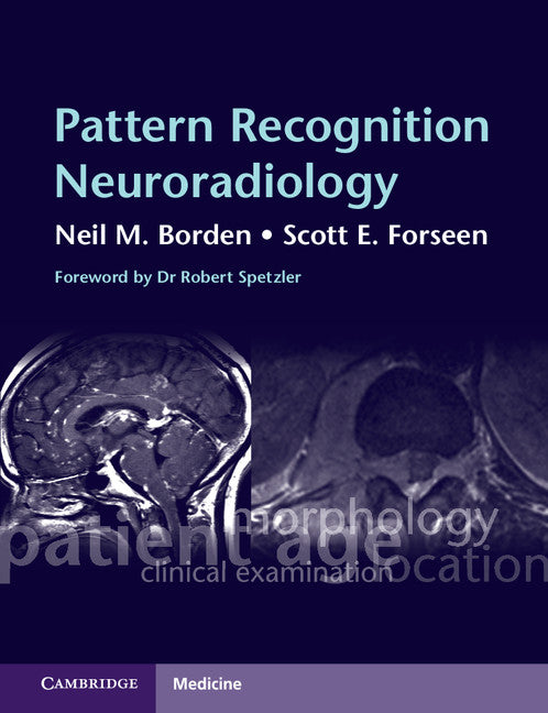 Pattern Recognition Neuroradiology (Paperback) 9780521727037