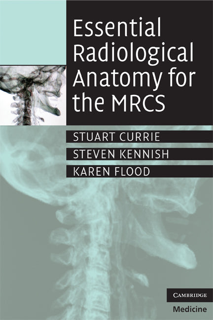 Essential Radiological Anatomy for the MRCS (Paperback) 9780521728089