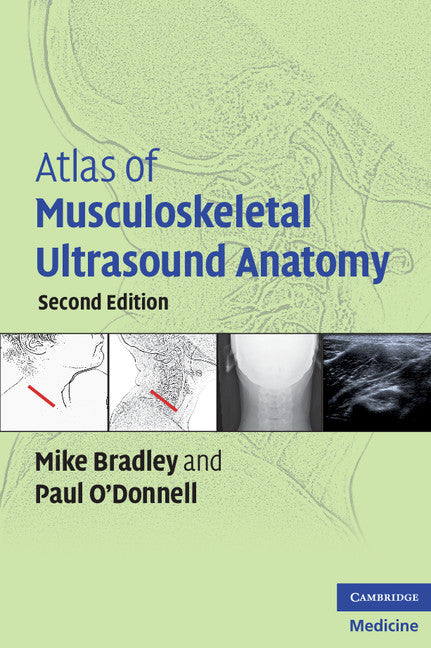 Atlas of Musculoskeletal Ultrasound Anatomy (Paperback) 9780521728096