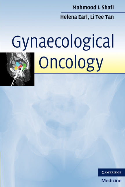 Gynaecological Oncology (Paperback) 9780521730242
