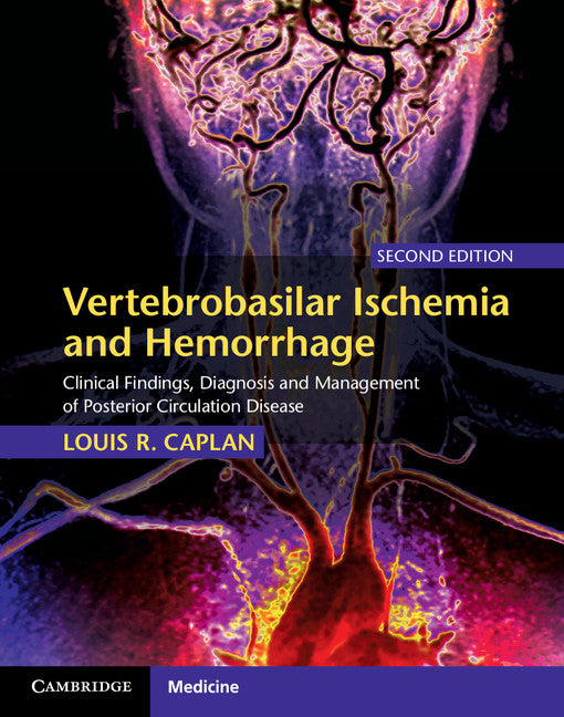 Vertebrobasilar Ischemia and Hemorrhage; Clinical Findings, Diagnosis and Management of Posterior Circulation Disease (Hardback) 9780521763066