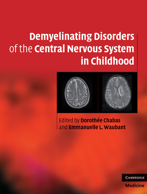 Demyelinating Disorders of the Central Nervous System in Childhood (Hardback) 9780521763493