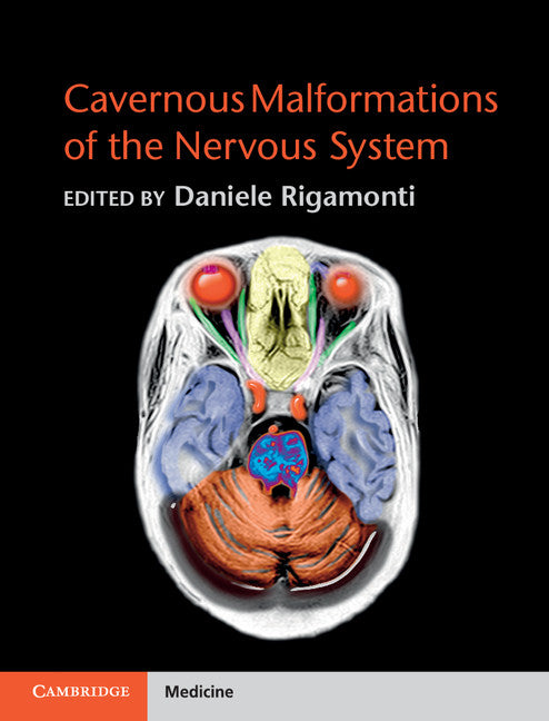 Cavernous Malformations of the Nervous System (Hardback) 9780521764278