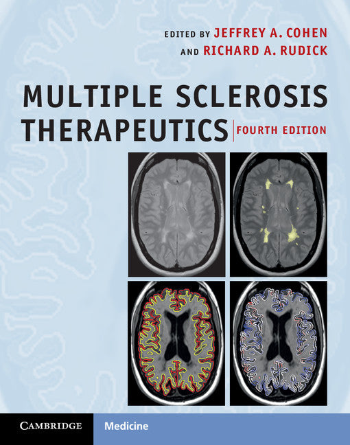 Multiple Sclerosis Therapeutics (Hardback) 9780521766272