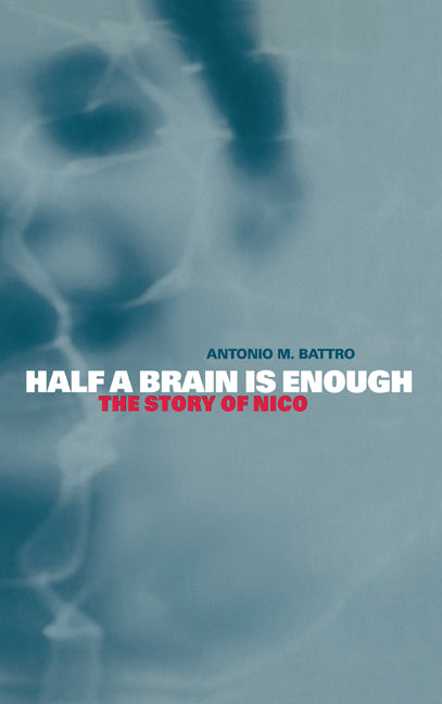 Half a Brain is Enough; The Story of Nico (Hardback) 9780521783071