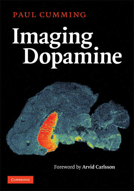 Imaging Dopamine (Hardback) 9780521790024