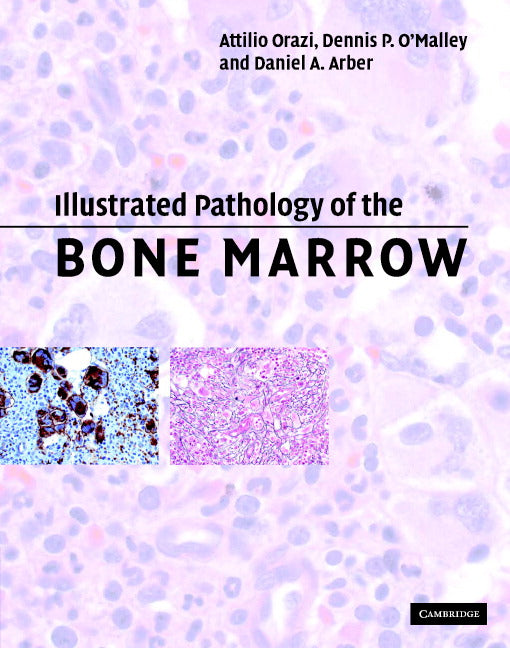 Illustrated Pathology of the Bone Marrow (Hardback) 9780521810036