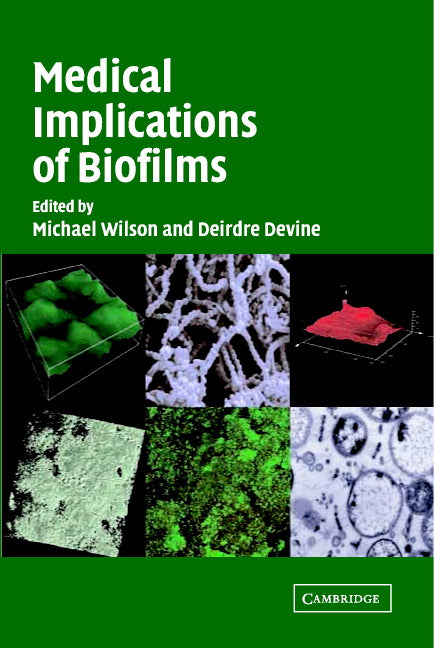 Medical Implications of Biofilms (Hardback) 9780521812405