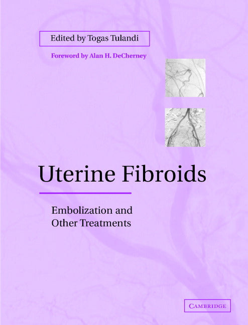 Uterine Fibroids; Embolization and other Treatments (Hardback) 9780521819381