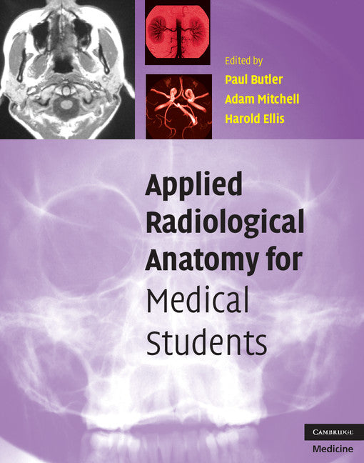 Applied Radiological Anatomy for Medical Students (Paperback) 9780521819398