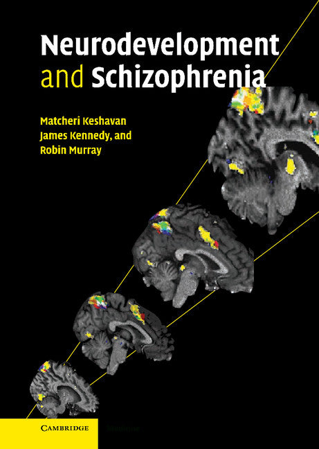 Neurodevelopment and Schizophrenia (Hardback) 9780521823319