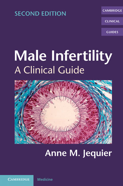 Male Infertility; A Clinical Guide (Paperback) 9780521831475