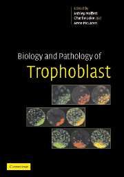 Biology and Pathology of Trophoblast (Paperback / softback) 9781107403154